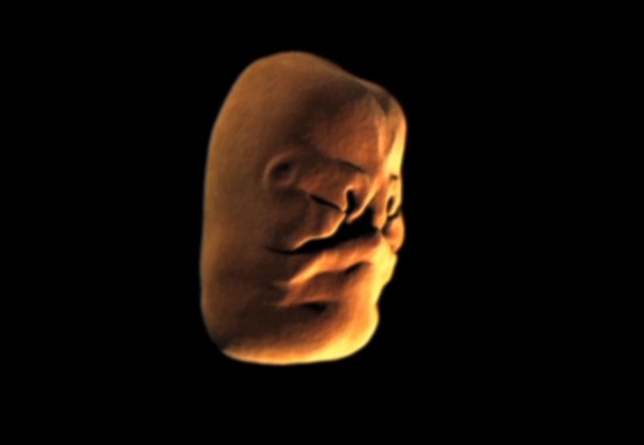Magzat arca (magzat, csecsemő, embrió, arc, )