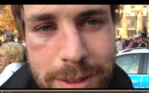 megvert újságíró (megvert újságíró, újságíró, )