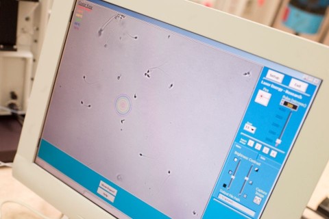 spermiumok (hímivarsejt, spermium, )