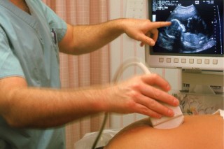 ultrahang-vizsgálat (ultrahang-vizsgálat, kismama, terhes, )