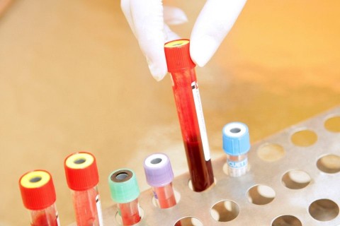 vérvizsgálat (vérvizsgálat, )