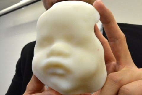 3d-s magzatfej (magzat 3d-ben)