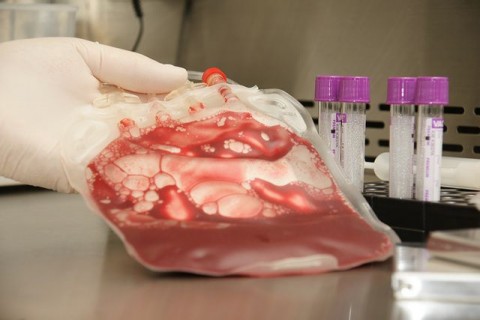 Őssejtbank (őssejtbank)