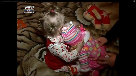 Alexa (moldova, születési rendellenesség, )