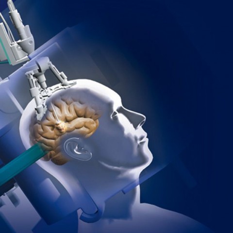 mri, agytumor (mri, )