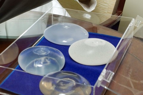 mellimplantatum(1)(210x140)(1).jpg (mellimplantátum, mellplasztika)