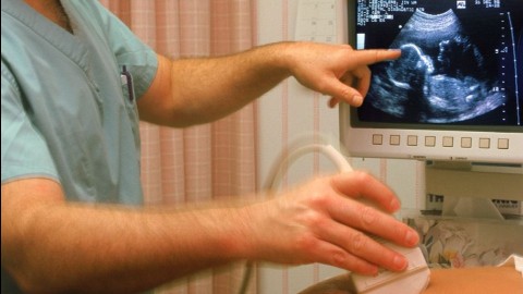 ultrahang-vizsgálat (ultrahang-vizsgálat, kismama, terhes, )