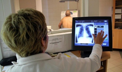 Tudoszures(960x640).jpg (Tüdőszűrés)