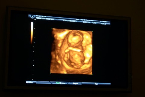 ultrahang-3d (magzat, )