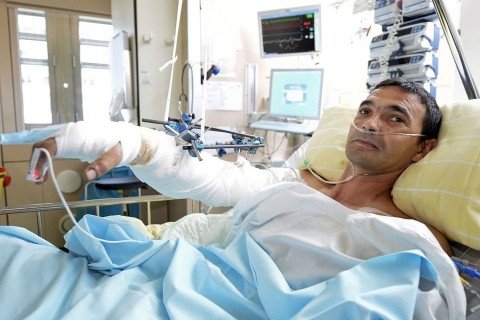 leszakadt-karu-ember(960x640)(1).jpg (leszakadt karú ember)