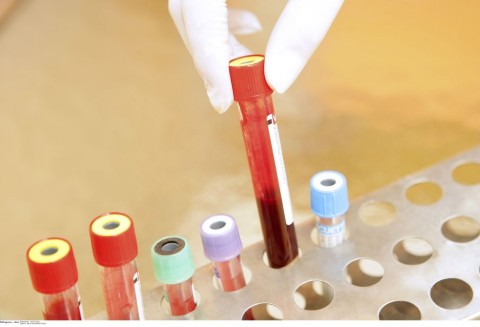 virus(960x640)(6).jpg (vírus, )