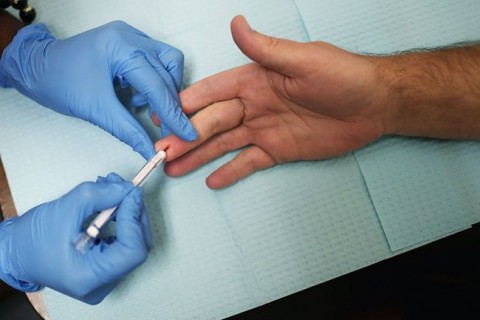 aids teszt (aids teszt)