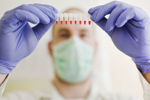 virus(960x640)(1).jpg (labor, vírus, kutatás, )