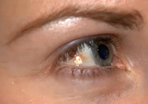 szemgolyó piercing (piercing, szem)