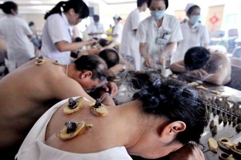 Akupunktúra (akupunktúra)