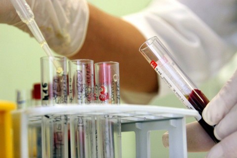 hepatitisz(430x286)(1).jpg (hepatitisz)