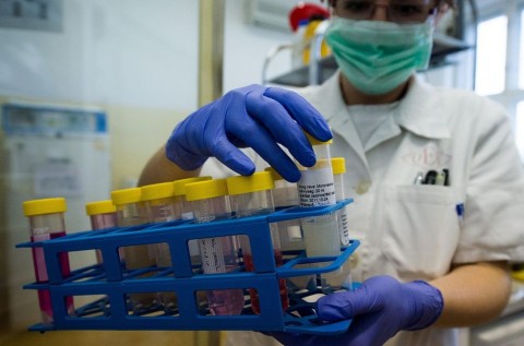 influenza (influenza)