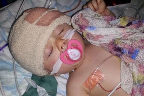 mutet(aa35ee68-5949-42a5-b912-9739725cb037)(960x640).jpg (műtét, )