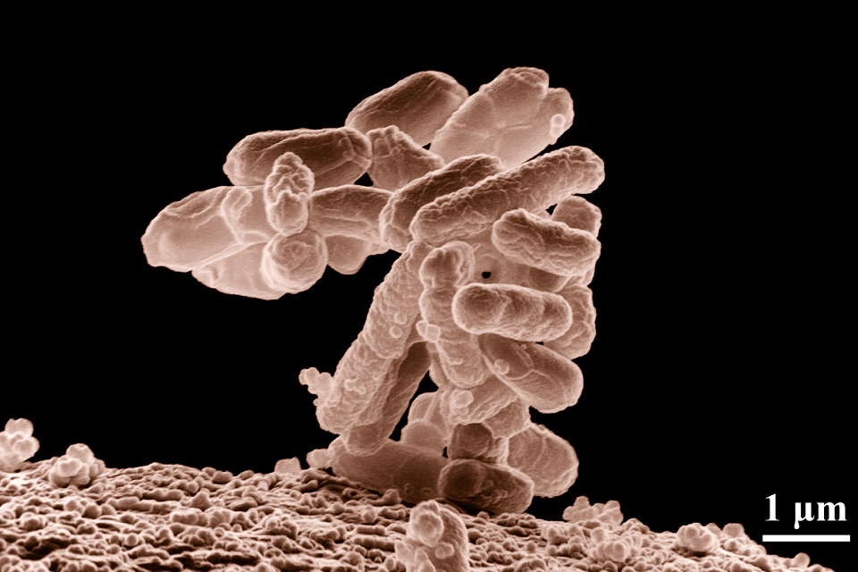 E coli baktérium (baktérium)