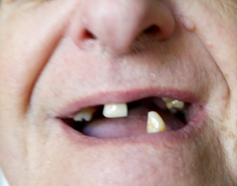 Fogatlan mosoly (fogatlan, mosoly, )