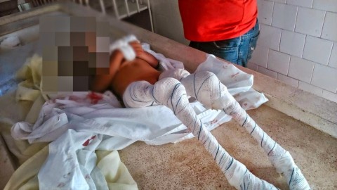 Piranha kislány (kislány, brazílila, piranha, )