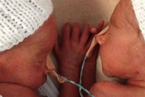 ikrek(960x640).jpg (ikrek, )