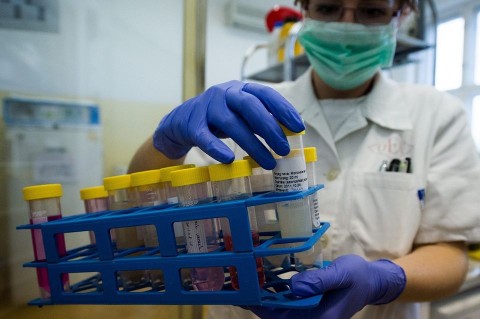 influenza (influenza)