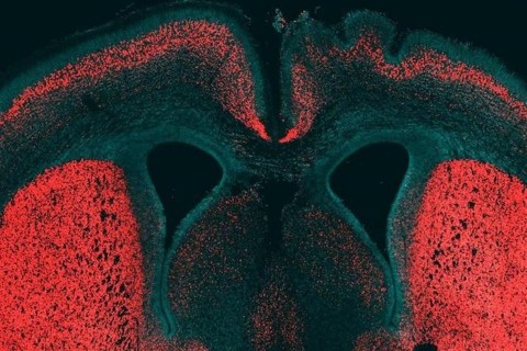 Szupergen(1)(1)(960x640).jpg (agy, agykutatás, genetika, fejlődés, tudomány, gén)