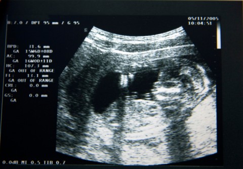 abortusz (abortusz, )