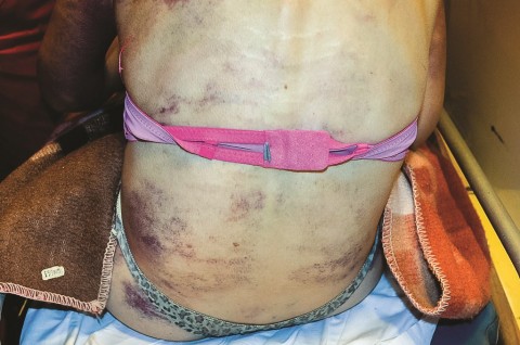 mucsi kínzás (Array)