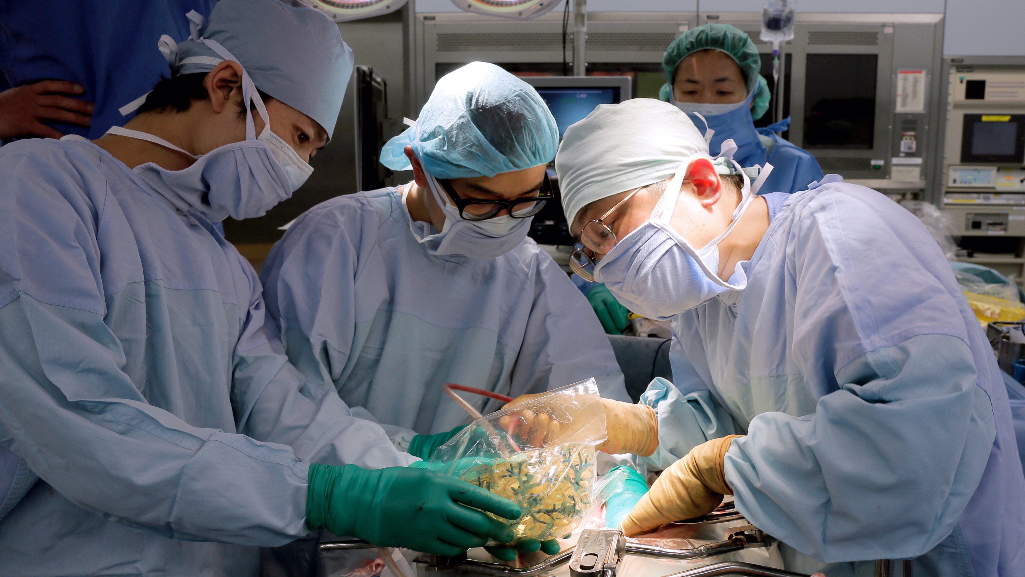 nyomtatott szerv 1 (nyomtatás, 3d nyomtatás, bionyomtatás, biológia, technológia, tudomány, forgács gábor, szerv, szervnyomtatás, implantátum, implantátum, beültetés, donor, )