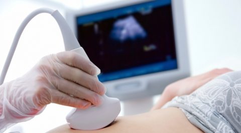 terhesség (terhesség, )