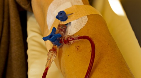 vérátömlesztés (vérátömlesztés, )