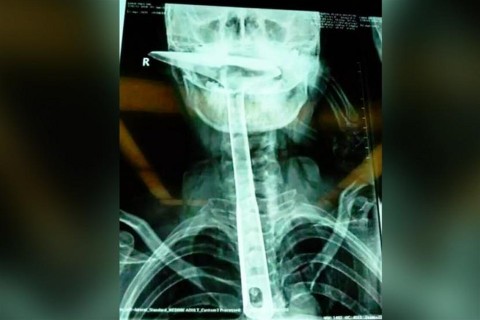 Lapatnyelo(960x640).jpg (Array)