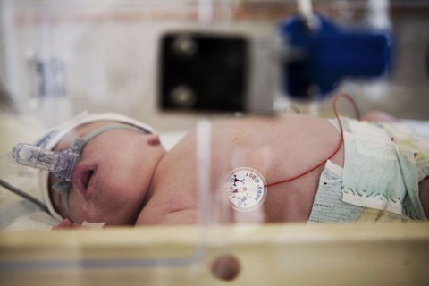 csecsemo(210x140).jpg (Array)