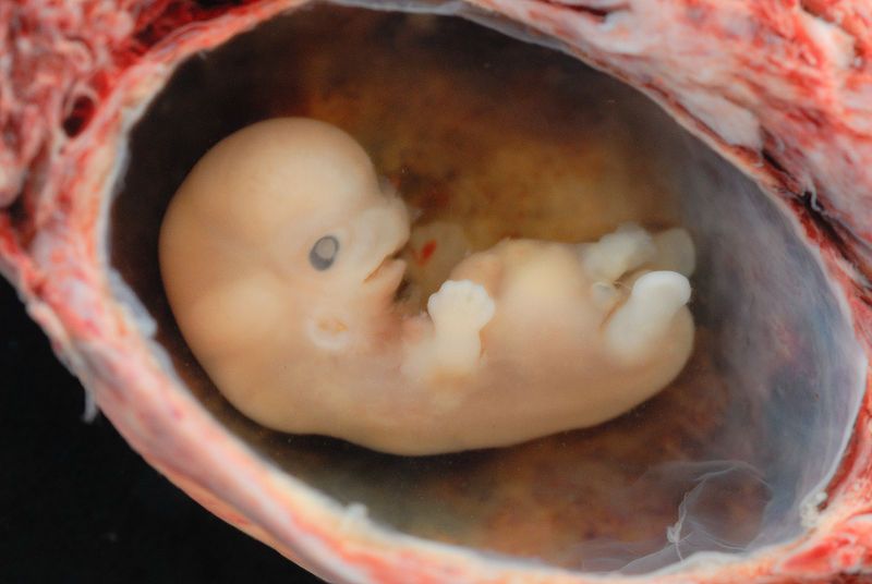 embrio(210x140).jpg (Array)