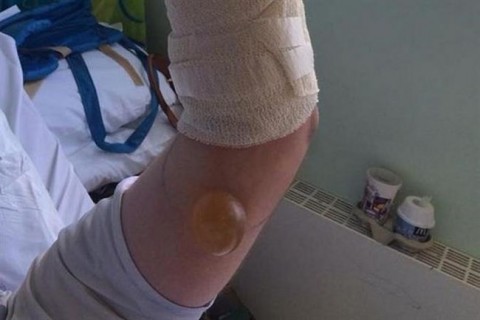 pokcsipes(650x433).jpg (Array)