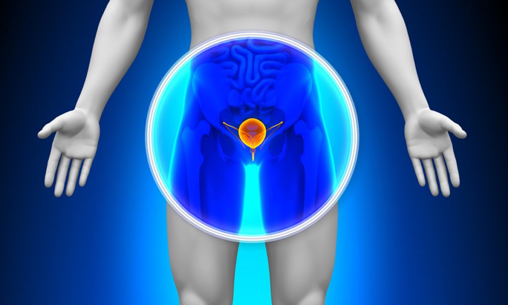 adenocarcinoma prostata o que é