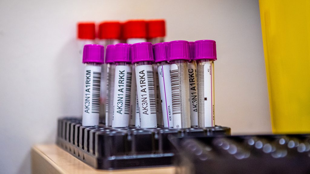 Negatív PCR-teszt nélküli lakók is visszamehetnek az idősotthonokba a kórházakból
