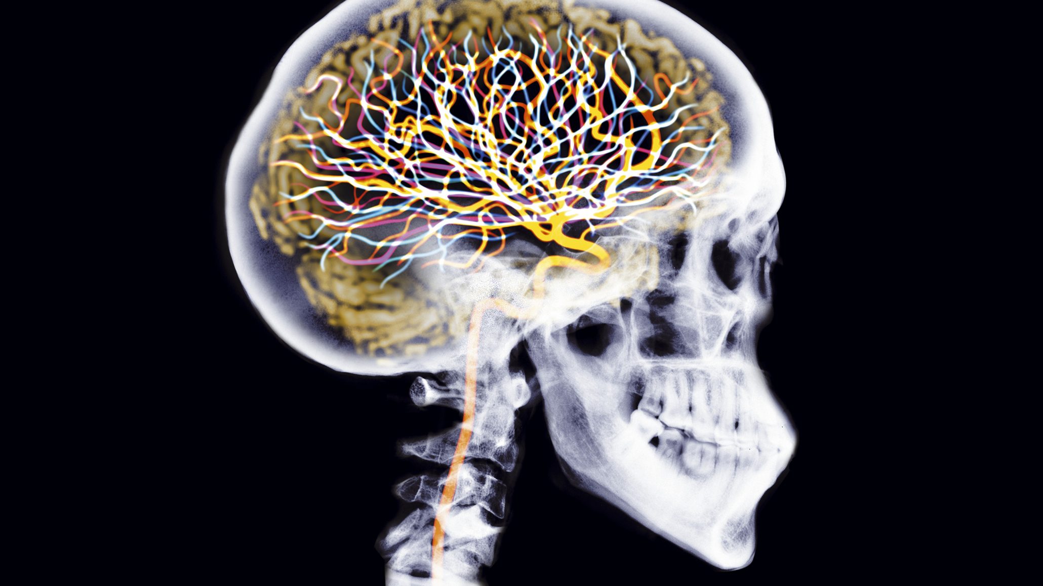 Brain 8 1. Мозг Нейроны внутри x ray. Art Exhibition Brain.