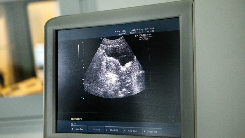 Kiderült, az utóbbi öt évben hány lombikbébi született Magyarországon