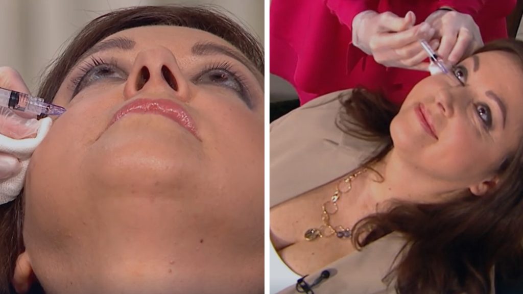 Elő adásban injekcióztak vitaminkoktélt Erdélyi Mónika szemkörnyékére