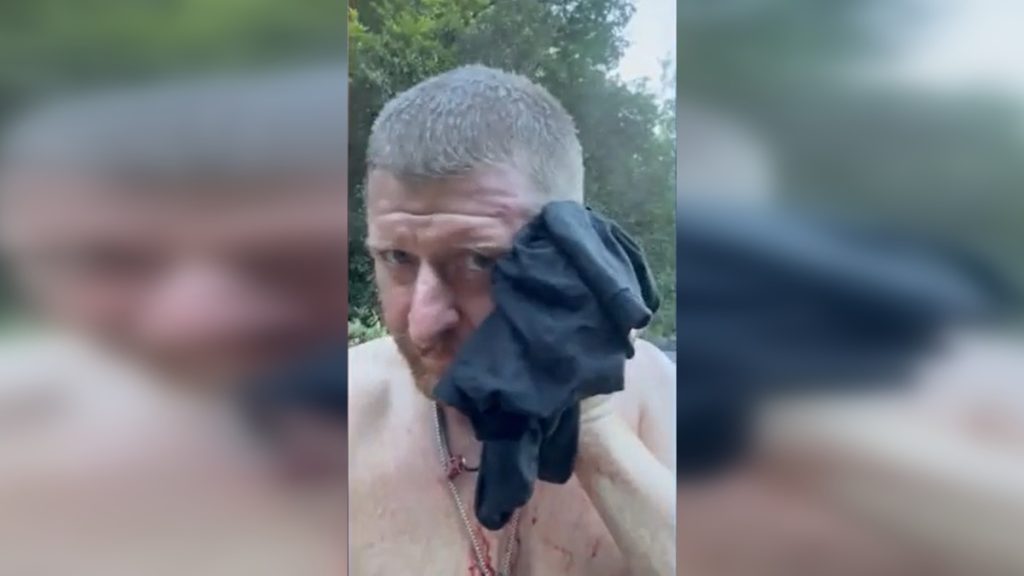 Ömlött az arcából a vér, miután megharapta egy kígyó