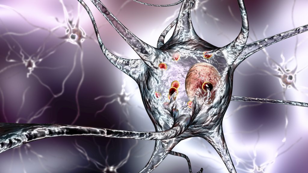 Megtalálhatták a Parkinson-kór fő okát