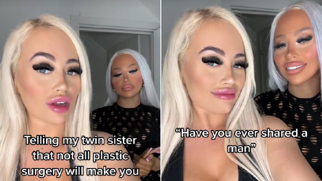 Egy vagyont költöttek az ikrek, hogy Barbie-ra és Playboy-nyuszikra hasonlítsanak