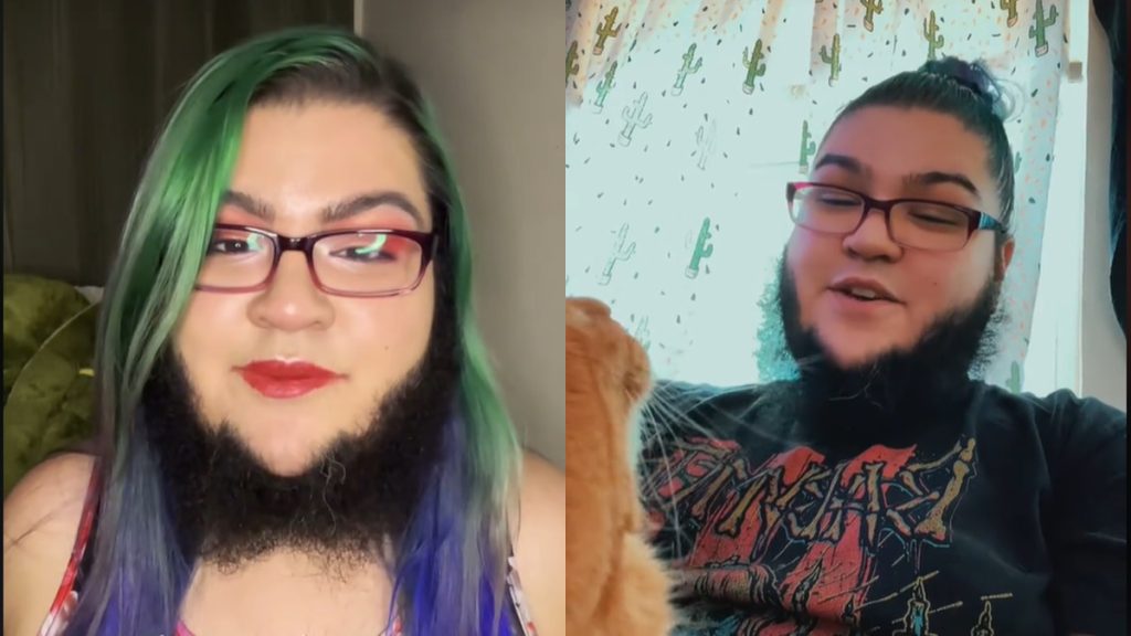 A szereteted attól függ, hogy szőrtelenít-e a másik? – teszi fel a kérdést a szakállas nő