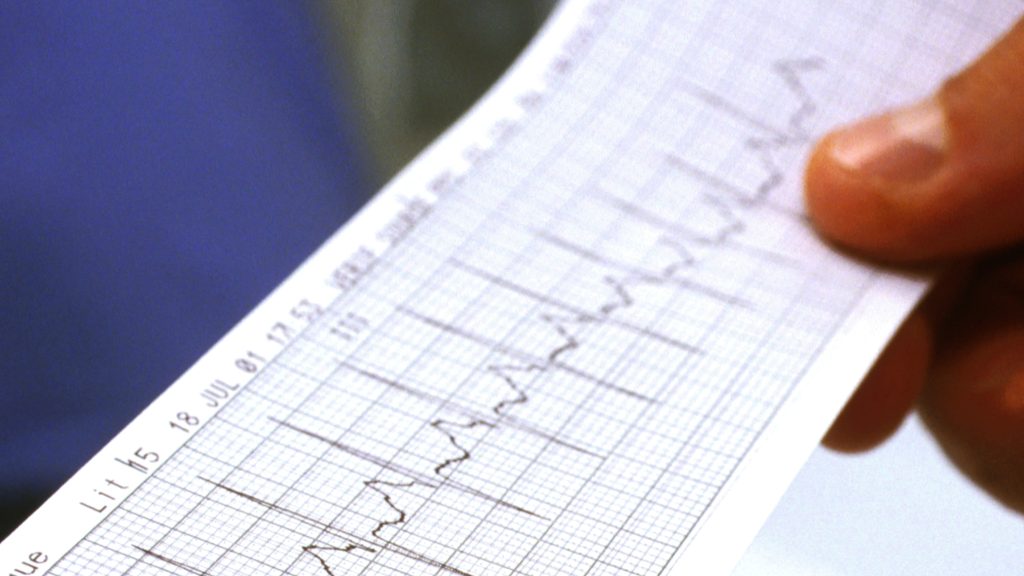 Van olyan hely, ahol 15 hónapot kell várni a kardiológiai szakrendelésre