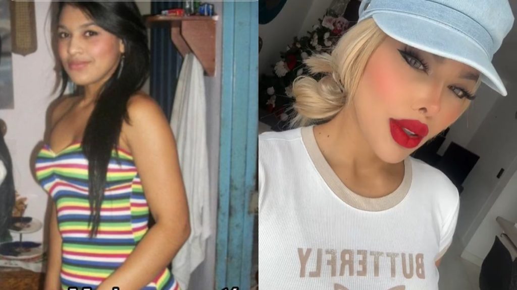 Fehér bőrű Barbie-vá alakította magát a modell, mert iskoláskorában csúfolták a bőrszíne miatt