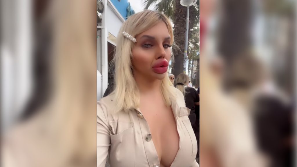 Nem tud rendesen enni az Európa legnagyobbjára feltöltött ajkai miatt