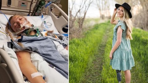 Törött lábbal egy villanyvezetékre akadva lógott egy órát a levegőben a szörnyű autóbalesetet túlélő idahói tini